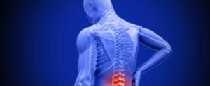 Fibromyalgia