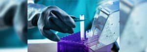 Cost of doing a Stemcell Banking?