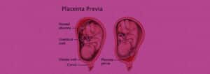 Difference between Umbilical Cord and Placenta