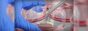 Private and Community Stemcell Banking